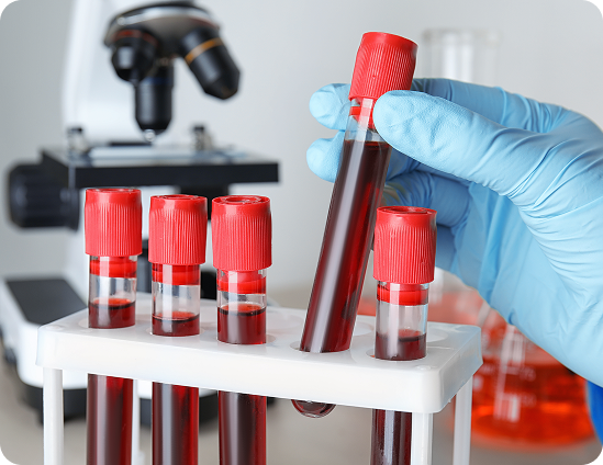 Buisjes bloed in een laboratorium